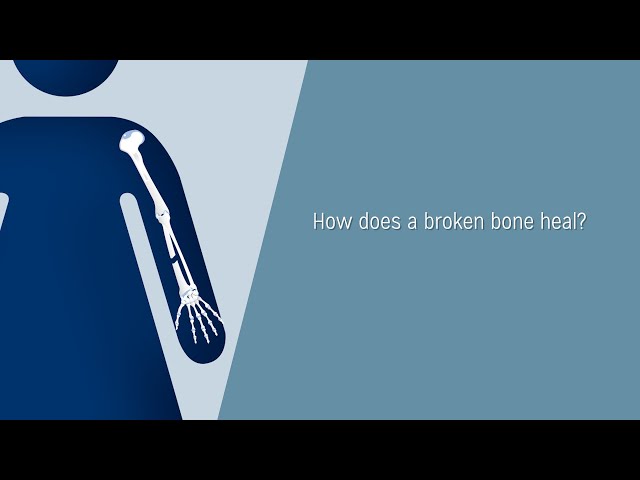 How does a bone heal?