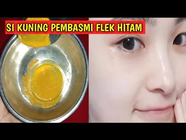 TANPA CREAM DOKTER !! PAKE INI AJA || WAJAH PUTIH,BERSIH KINCLONG FLEK HITAM RONTOK TANPA SISA