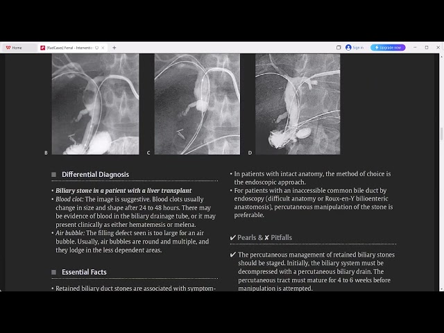 IR RAD CASE SERIES