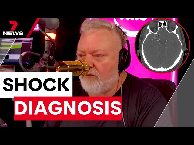 Kyle Sandilands reveals he’s been diagnosed with a brain aneurysm | 7NEWS