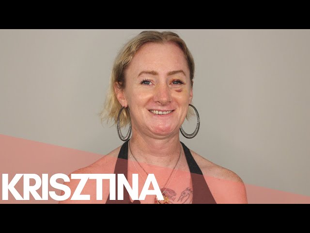 Krisztina — FFS Surgery Stories