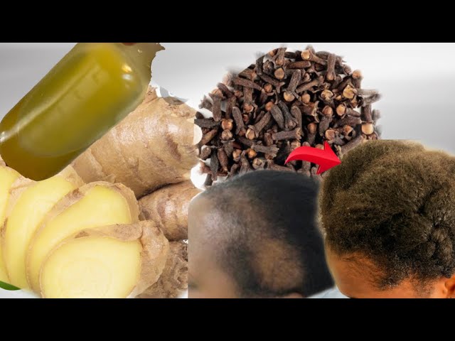 I used GINGER AND CLOVES in my hair then this happened!CLOVES and GINGER for Hair growth