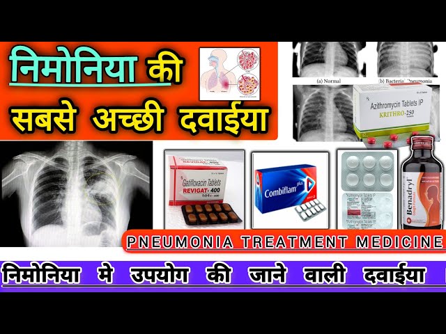 Symptoms & Treatment of Pneumonia | निमोनिया की सबसे अच्छी दवाईया |Pharmacy |Doctor