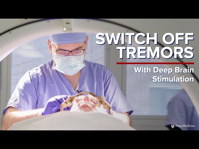 Deep Brain Stimulation (DBS) for Movement Disorders | Penn Medicine