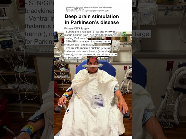 Deep brain stimulation in Parkinson’s disease