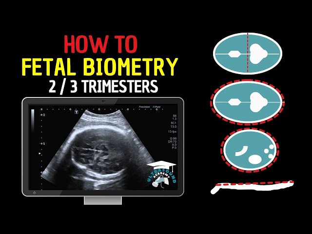 How to Perform Fetal Biometry in the Second and Third Trimesters | Practical Guide