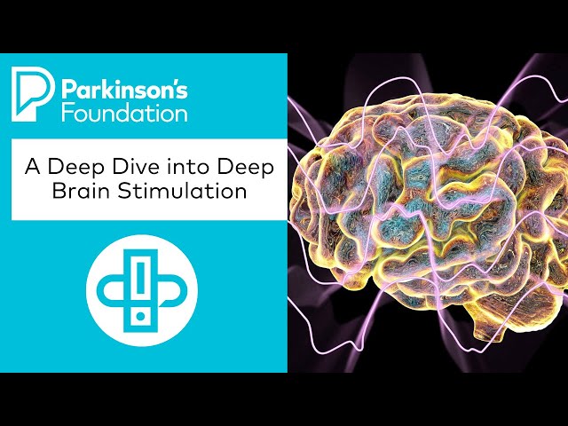 A Deep Dive into Deep Brain Stimulation | Parkinson's Foundation