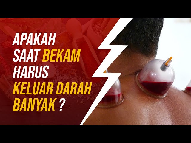 Apakah Bekam Harus Keluar Darah Banyak ?