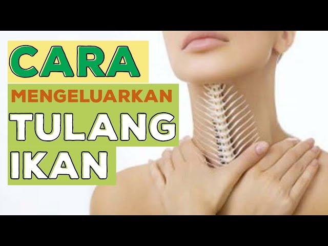 Cara Hilangkan Tulang Ikan Yang Tersangkut Di Tenggorokan