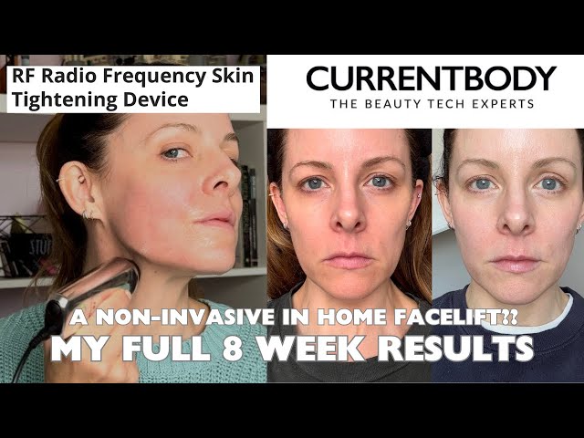 MY RESULTS! 8 WEEK UPDATE - Full test of Current Body RF Radio Frequency Device - At home facelift?