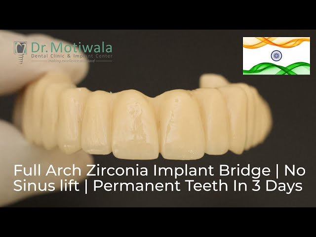 Edentulous case: Full Arch Zirconia Implant Bridge Success Story | Permanent Teeth in 3 Days