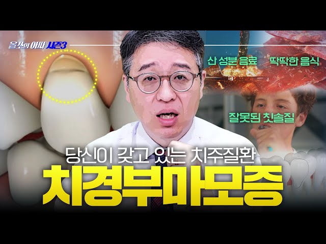 이시림, 충치가 아닌 치경부마모증이라고? 🦷 – [올쏘의 아싸 시즌3] EP45