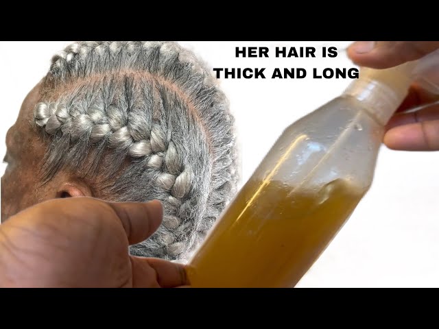 I tried her hair growth recipe! My hair grew thicker and longer. works for all hair types!