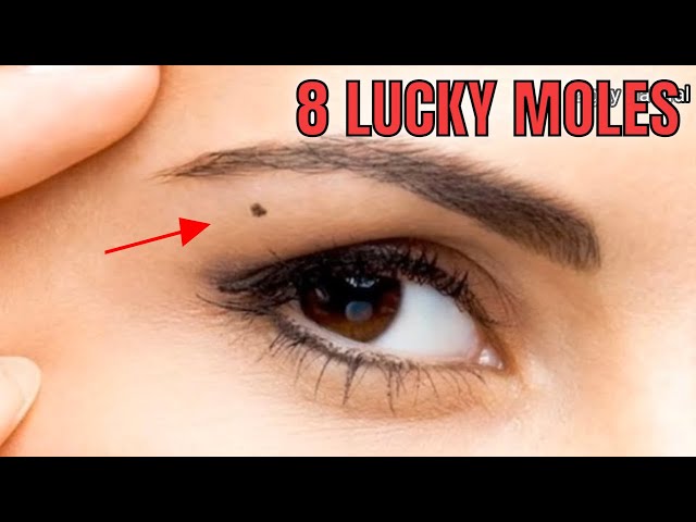 You Are Considered Really Lucky If You Have Moles On These 8 Body Parts - Maswerteng Nunal