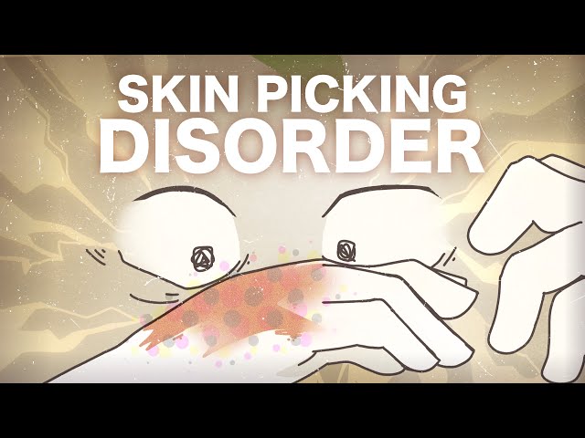 Skin Picking Disorder .. What is it?