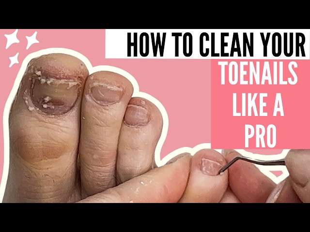 ow to Pedicure Your Own Feet at Home: Step-by-Step Pedicure Tutorial, Toenail Cleaning, & Care