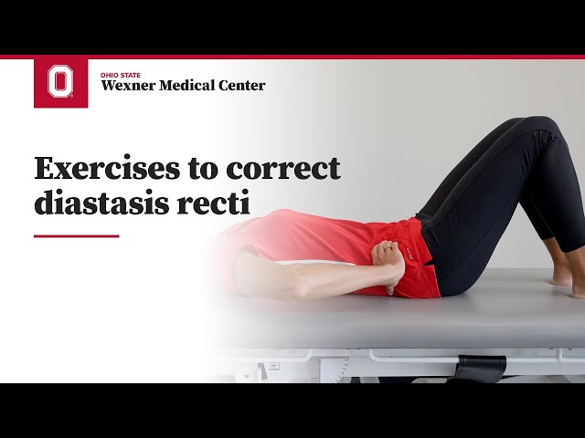 Exercises to correct diastasis recti | Ohio State Medical Center