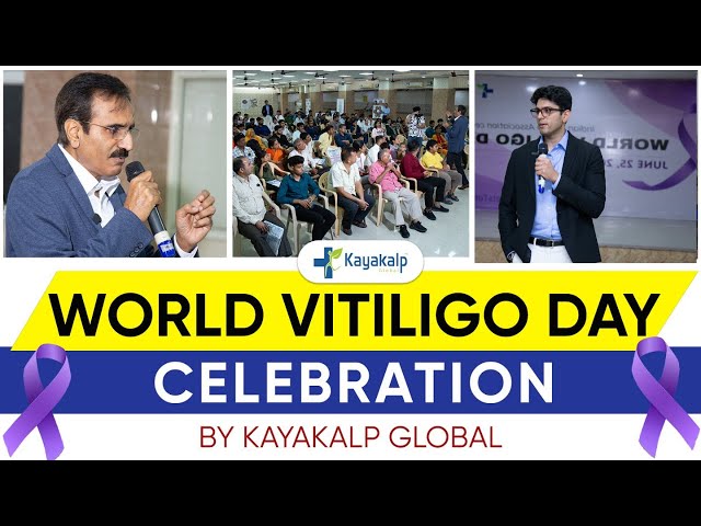 🥊World Vitiligo Day Celebration by Kayakalp Global | Vitiligo Treatment | Kayakalp Global