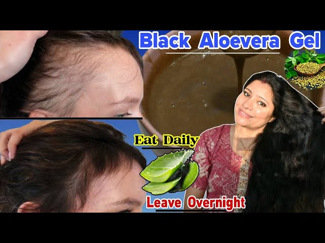 Black Aloevera Gel To Make Hair 20×Thicker Naturally & Regrow Hair Fast ।Garima Singh।