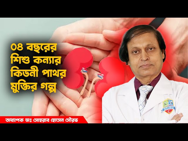 ০৪ বছরের শিশু কন্যার কিডনী পাথর মুক্তির গল্প । হাসপাতাল