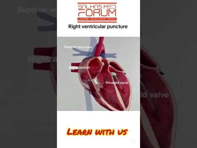 Right ventricular puncture | 3d animation | HassanIqbalMLT #anemiayoutubeshort