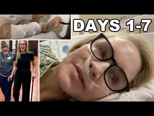 HIP REPLACEMENT DIARY | MY CRAZY FIRST WEEK After Surgery | Plus Getting Covid & Quitting CARNIVORE