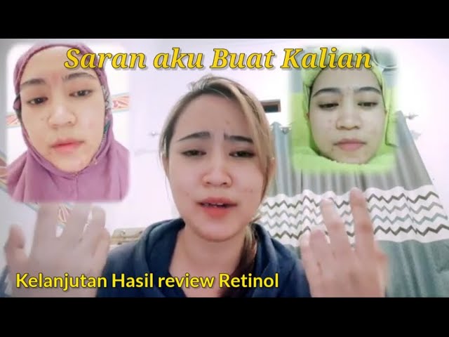 Review JUJUR Retinol setelah lepas dari MS glow Part 2  #retinol #skincare  #review360p