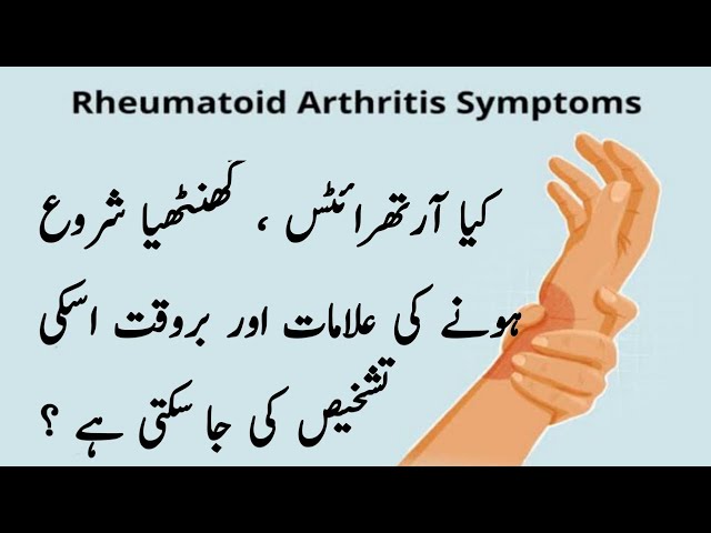 Early Warning Signs Of Rheumatoid Arthritis | Don't Ignore These Vital Symptoms | Home Tips Daily