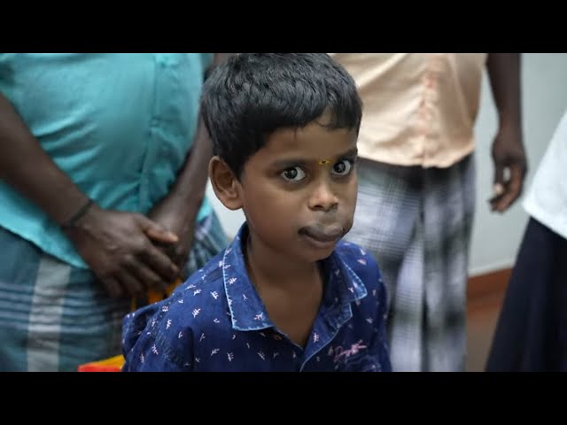 Small Boy with Severe Lip Hemangioma Surgery Consultation