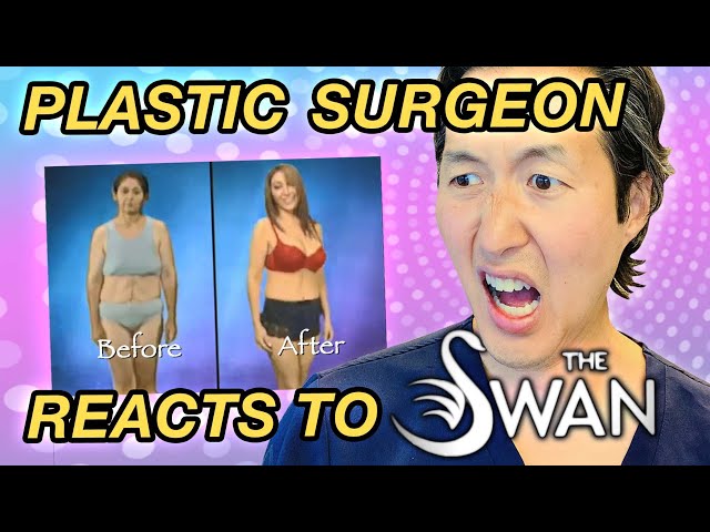 Plastic Surgeon Reacts to THE SWAN! WTF Is This Show?!?!