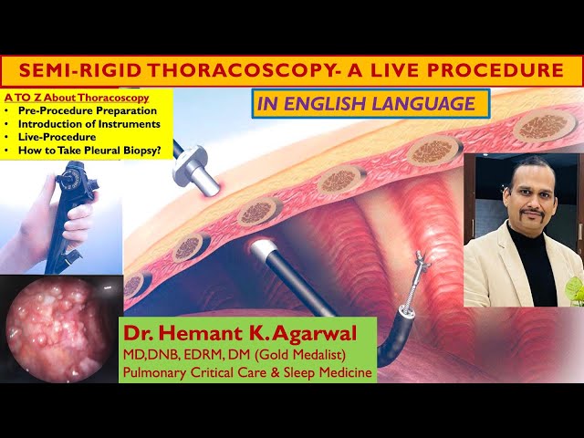 Semi Rigid Medical Thoracoscopy (ENGLISH) In Undiagnosed Exudative Pleural Effusion @Dr. Hemant