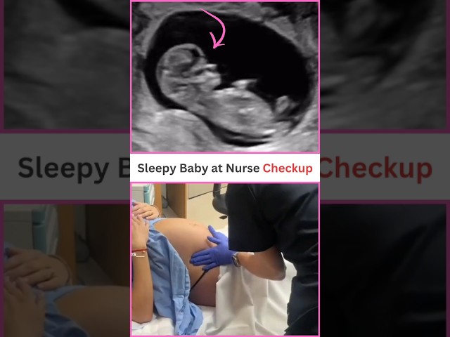 Nurse Checkup 😍😍 baby girl ultrasound in the womb#pregnancy #fetus #shorts