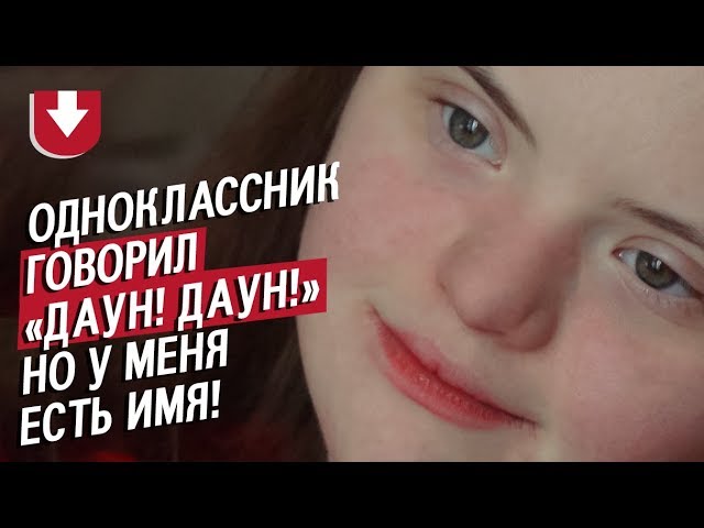 Девушка с синдромом Дауна: Аня | Быть молодым