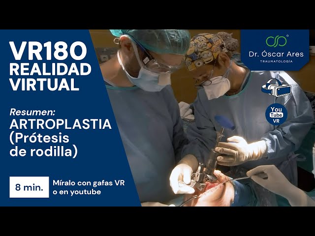 VR180 Cirugía Resumen ARTROPLASTIA (Prótesis de rodilla) - Dr. Oscar Ares