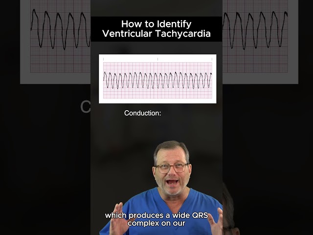 Wide QRS? It Could Be Ventricular Tachycardia! ⚡️