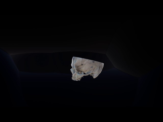 VIDEO 1: VR (360-degree stereoscopic) video showing a lateral-to-medial view of the cranial fossae