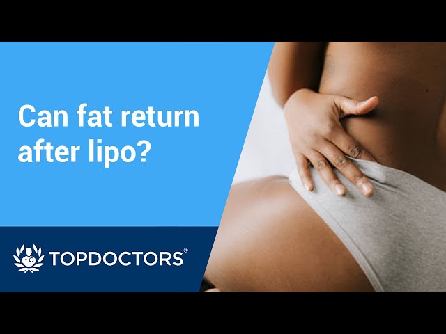 Liposuction: can fat return after surgery?