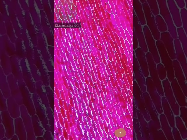 ONION PEEL UNDER MICROSCOPE 😍| #onion #shorts #microscope #science #biomedictation