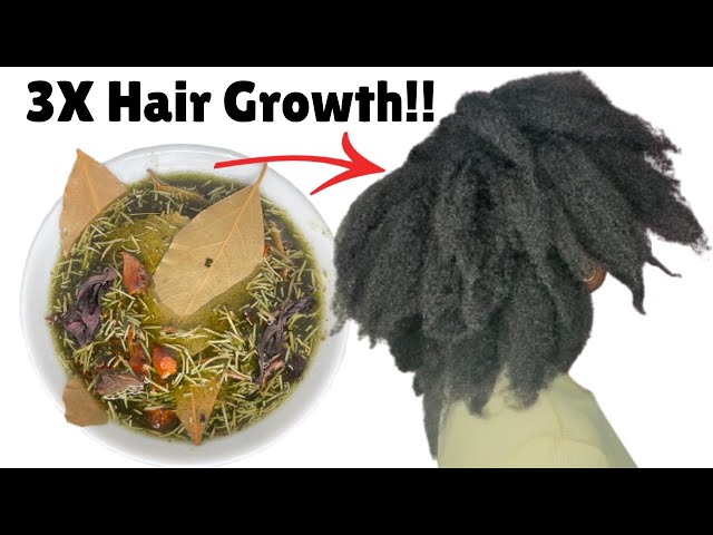 USE THIS for 3x GUARANTEED HAIR GROWTH | DIY HAIR GROWTH OIL for Thick and Bushy Hair! #hairgrowth