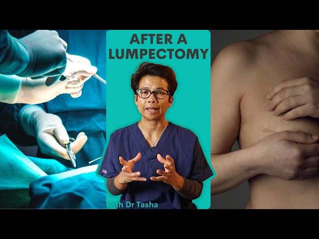 6 Things to expect following a lumpectomy with Dr Tasha