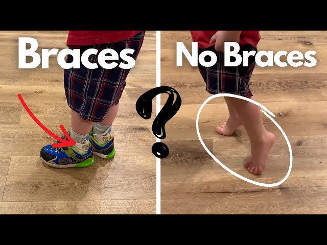 Toe Walking Mild Autistic 2-year-old gets Braces