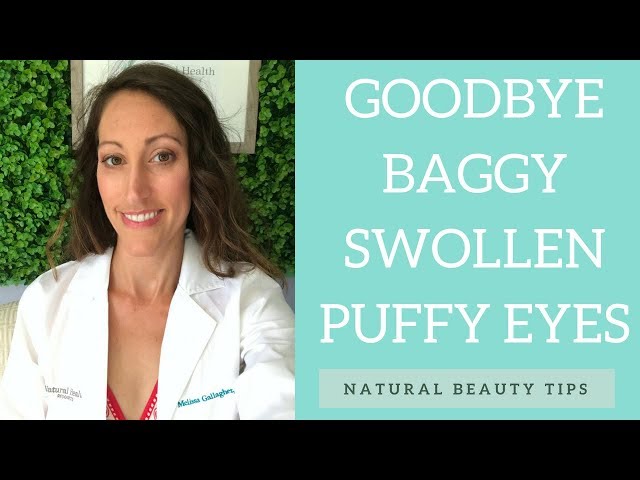 3 EASY Ways To Get Rid of Under Eye Puffiness, Dark Circles & Swollen Eyes Bags | Natural Beauty Tip