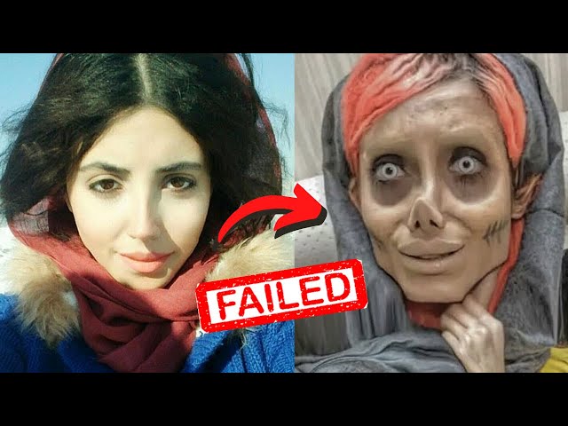 How Plastic Surgery Ruined Her Life - Sahar Tabar