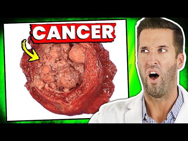 Is There a Cure for Cancer? | Reacting to Your Medical Questions