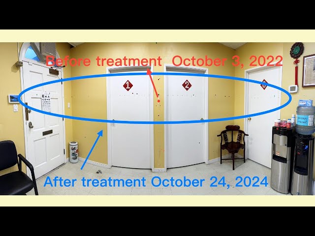 From Dependence to Independence: Pranav Has Gained Back His Visual Field #retinitispigmentosa