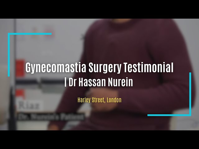 Gynecomastia Surgery Testimonial | Dr Hassan Nurein