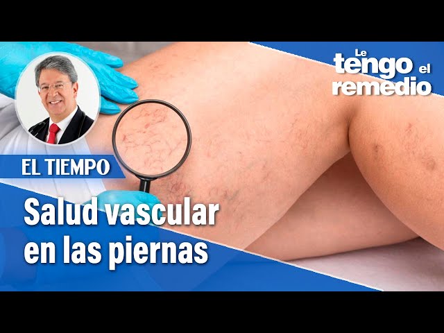 Salud vascular en las piernas | Le tengo el remedio