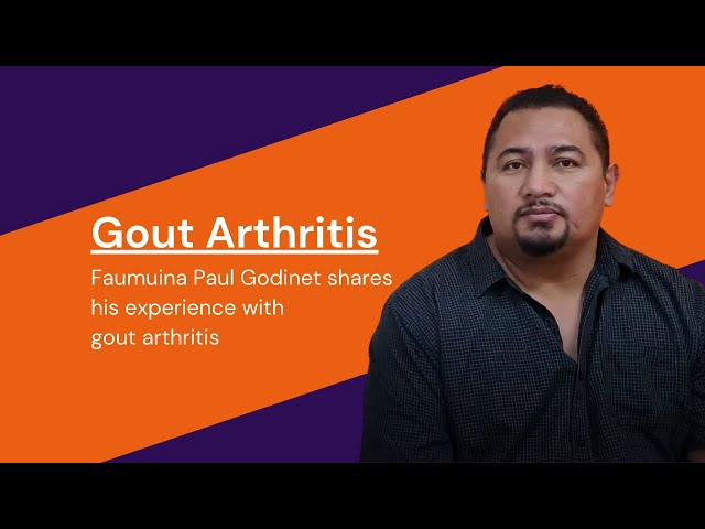 What You Can Do For Your Gout Arthritis - Faumuina Paul Godinet