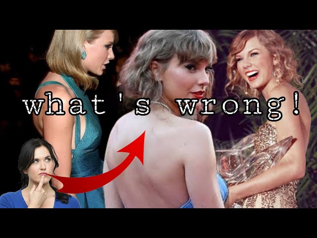 What's wrong with Taylor Swift's back ? | Taylor swift | Info #taylorswift