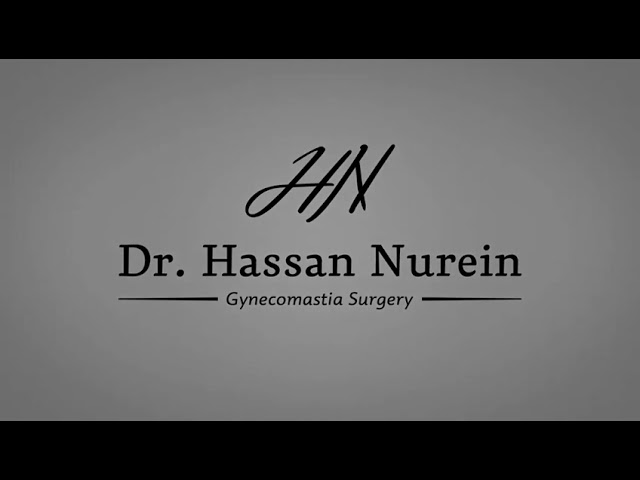 Gynecomastia Surgery- Moderate to Severe Cases- Before & After Results | Dr Hassan Nurein